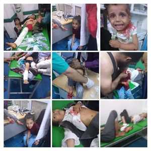 بالتزامن مع زيارة المستشار العسكري للمبعوث ..اصابة 11طفلا في قصف حوثي استهدف حي سكني بتعز.