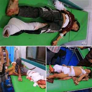 مقتل مواطن وإصابة خمسة  أطفال في قصف لمليشيا الحوثي استهدف مدينة تعز .
