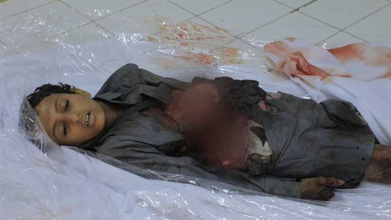 وزير حقوق الإنسان يطالب بموقف دولي صارم لايقاف جرائم المليشيا تجاه المدنيين في مأرب