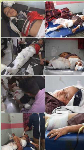 استشهاد ثلاثة أطفال من أسرة واحدة وإصابة آخرين بقصف حوثي لحي سكني بمدينة تعز